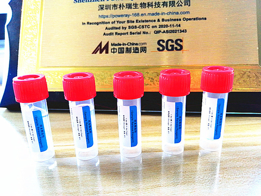 الموافقة على SGS PCR Test Home Kit DNA و RNA Extraction for Covid-19